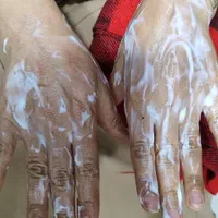فیلر از خون شما