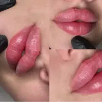 تزریق ژل لب و گونه و چانه.. (جشنواره)درمطب فقط599ت|خدمات آرایشگری و زیبایی|اصفهان, باغ زیار|دیوار