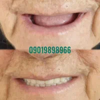 دندانسازی|خدمات آرایشگری و زیبایی|خرم‌آباد, |دیوار