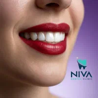 ایمپلنت اقساط 12 ماه