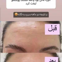 کرم جوانساز و سرم جوانساز بی نظیر