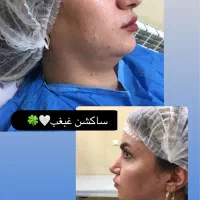 آموزش،پی ار پی مزوبوتاکس بایوفیلر غبغب چربی ساکشن|خدمات آرایشگری و زیبایی|اصفهان, شاهزید|دیوار