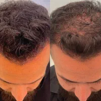 ۲۵ سالته ولی انگار ۴۰ سالته