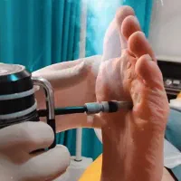 مرکز درمان و پاکسازی کامل زگیلهای پوستی و تناسلی
