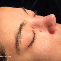زیبایی بینی۲۹تومن با متخصص گوش و حلق و بینی