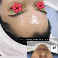 فیشال تخصصی و درمانی با برند کلینیکی کره جنوبی|خدمات آرایشگری و زیبایی|بندر کنگان, |دیوار