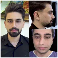 جراحی عمل بینی لیپو ابدو لیفت پروتز پیکرتراشی|خدمات آرایشگری و زیبایی|تهران, فلسطین (میدان انقلاب)|دیوار