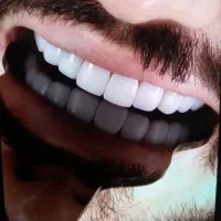 کامپوزیت. لمینیت . خدمات درمان. و ایمپلنت.و متحرک