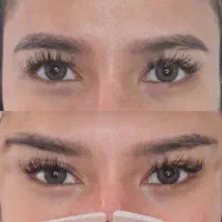 مطب پزشک.ژل وبوتاکس.لیفت بانخ.فیلربینی ژل آلت|خدمات آرایشگری و زیبایی|قم, دورشهر|دیوار