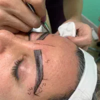 کاشت مو اقتصادی فقط ۲۰ تومن|خدمات زیبایی و سلامت|تهران, شهرک آزمایش|دیوار