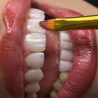 لبخند هالیوودی با قیمت عالی