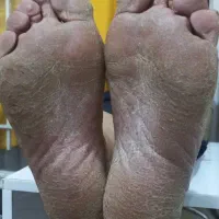 انجام تخصصی اسپاوکفسابی پاومدل برای کراتین موی سر