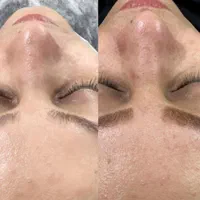 فیشیال تخصصی پوست شما