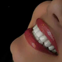 تخفیف ویژه کامپوزیت و لمینت دندان