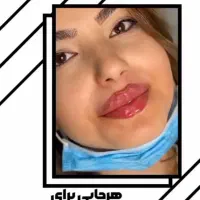 تخفیف ویژه خدمات ژل و بوتاکس|خدمات آرایشگری و زیبایی|زابل, |دیوار