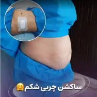 ساکشن هر ناحیه ۶ملیون