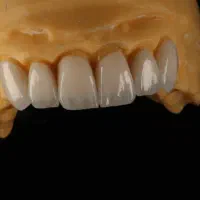 به یک نفر خانم در لابراتوار دندانسازی نیازمندیم