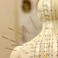 انجام کایروپراکتیک.حجامت.فصد.طب سوزنی