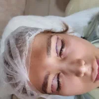 جشنواره. بلفاروپلاسی. تزریق چربی. اتوپلاسی