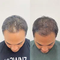 پرپشتی میخوای پیام بده