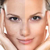 تکنیک اروپایی فیلینگز