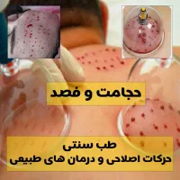 سیاتیک،حجامت،طب سنتی،مفاصل،حرکات اصلاحی|خدمات آرایشگری و زیبایی|اصفهان, ارداجی|دیوار