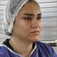 تزریق ژل بوتاکس هایفوتراپی بلفاروپلاستی توسط پزشک|خدمات آرایشگری و زیبایی|تبریز, |دیوار