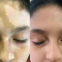 درمان با روغن های گیاهی و اموزش درامد انلاین|استخدام درمانی، زیبایی، بهداشتی|دره شهر, |دیوار