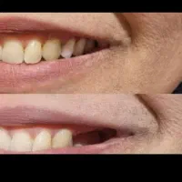 لابراتوار دندانسازی(نیودنت Newdent)|خدمات آرایشگری و زیبایی|کاشمر, |دیوار