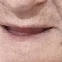 ساخت و ترمیم پروتزهای متحرک و ثابت