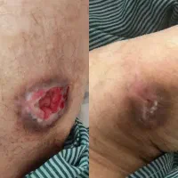 کلینیک تخصصی درمان زخم ( بستر و دیابت) فردوس|خدمات آرایشگری و زیبایی|اصفهان, بهار آزادی|دیوار