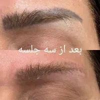 لیزر پاک کردن تتو بشکل مدرن|خدمات آرایشگری و زیبایی|اهواز, فرهنگ شهر|دیوار