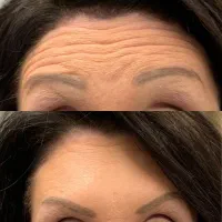 متخصص پوست ومو،زیبایی