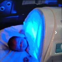 اجاره دستگاه زردی نوزاد (فتوتراپی)