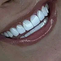 نیاز به دندانپزشک جراح جهت ایمپلنت و درمانی