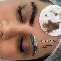 ریموو تاتو،میکروبلیدینگ ابرو،فیبروز ابرو،شیدینگ لب