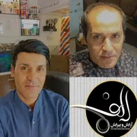 کلینیک پروتز دائمی مو ترمیم مو الف