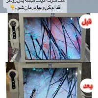 درمان ریزش مو،پوسته،شوره،خارش و بیماری های قارچی|خدمات آرایشگری و زیبایی|شیراز, شهرک امیر کبیر|دیوار