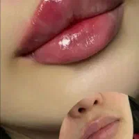 جشنواره ی تخصصی فیلر وبوتاکس