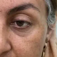 کرم گیاهی سفید کننده|آرایشی، بهداشتی، درمانی|زنجان, |دیوار