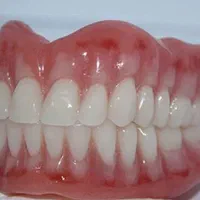 دندانسازی/پروتز متحرک/دندان مصنوعی/دست دندان|خدمات آرایشگری و زیبایی|کرج, برغان|دیوار