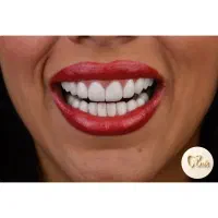 دندان پزشکی|خدمات آرایشگری و زیبایی|قم, نوقطار|دیوار