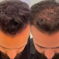 چجوری تحمل میکنی موهاتو
