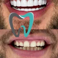 خدمات دندانپزشکی درمانی/زیبایی