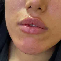 جشنواره فیلر لب فقط ۱۵۰۰