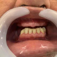 دندان مصنوعی|خدمات آرایشگری و زیبایی|گالیکش, |دیوار