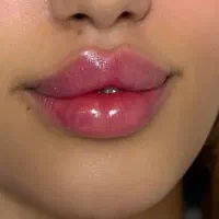 تزریق ژل بوتاکس تتو لیزر تتو تک جلسه چالگونه