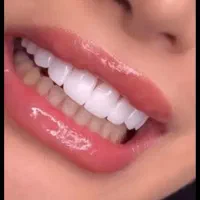 مواد کامپوزیت