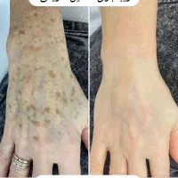 تضمینی لکه هارو محو کن