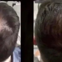 موهاتو مثل جنگل پر پشتی کن